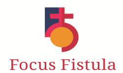 Focus Fistula